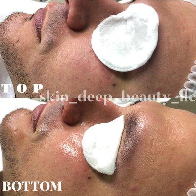 Skin Deep Customized Facial.