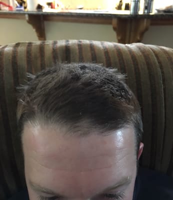 Here is the bald spot they cut in his head.