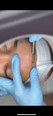 Dermaplaning Facial