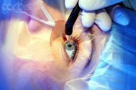 Dr. Goldberg  Eye Surgery Centers