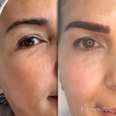 Micropigmentation Before and After