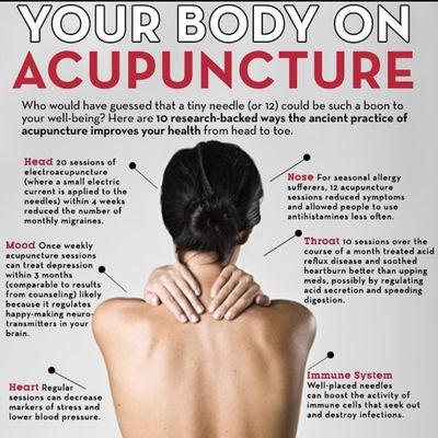 Juno Wellness Acupuncture