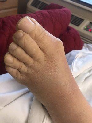 My mother's foot has been an issue and I have requested for a podiatrist, not one seen her yet.