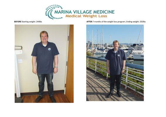 Before and After- Weight loss patient