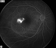 Mid Atlantic Retina