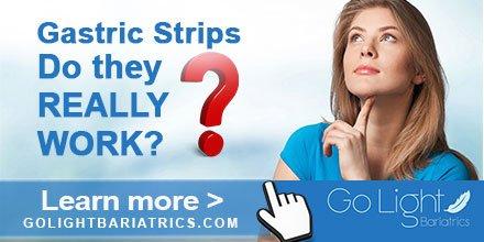 Weight Loss Bariatrics Surgery Gastric Strips do they really work? Learn more here