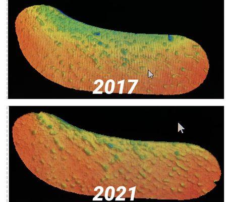 Red= collagen
Blue= breakdown (wrinkles) 
Come see what YOURS looks like!