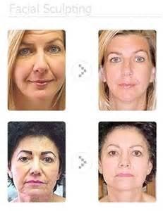 Before and After Anti-Aging Facial