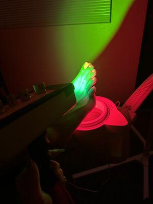 Green light therapy and red light therapy for neuroma of the foot