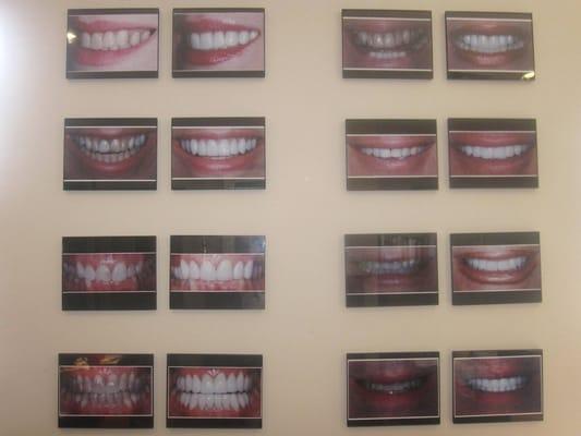 Some of  Dr. Kraus' Before and After photos displayed in his office.