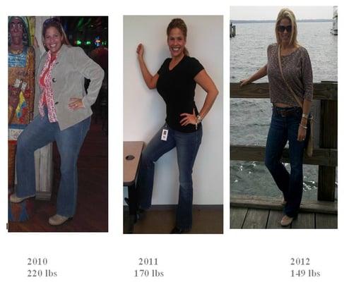 Before and After for HCG Diet Weight Loss Program