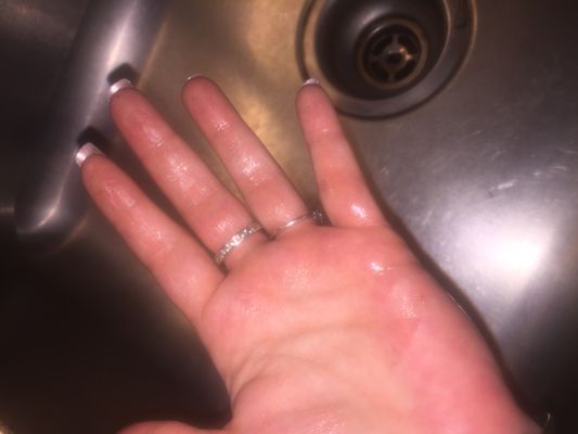 Grease all over my hands.  Disgusting.