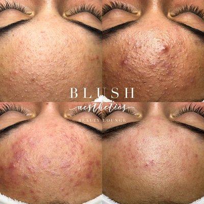 Blush Aesthetics Beauty Lounge