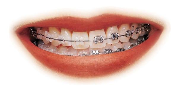 ChangDMD Orthodontics