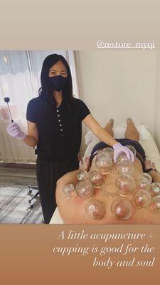 Dr. Chen helping me with lower back pains using the cupping technique.