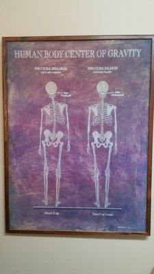 Atlas (C1) malposition effects the entire skeletal system