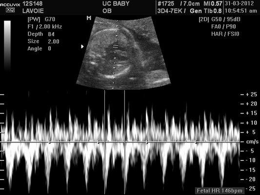 Hear your baby's heartbeat with our ultrasound services.