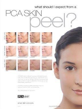 Realistic expectations from PCA Skin's chemical peels.