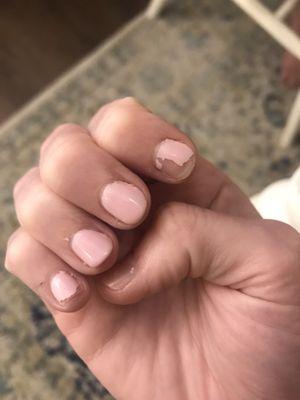 6 days after gel manicure