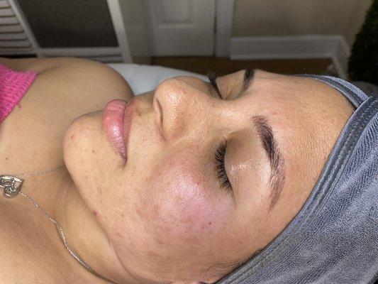 Deepcleasing Facial