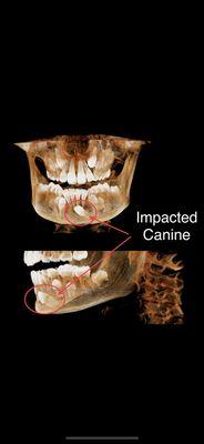 CBCT dental imaging