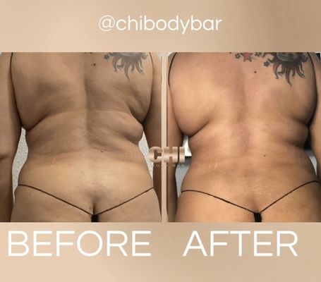 Chi Body Bar