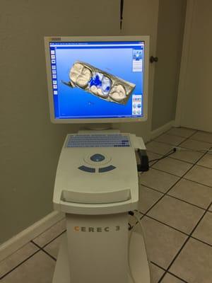 Cerec Machine,  so we are able to make crowns and onlays in only one visit for your convenience