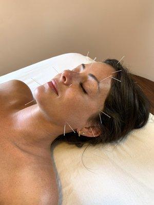 Face & Body Rejuvenation