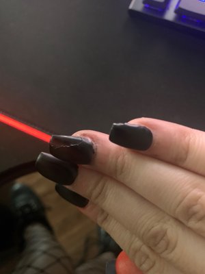 Chipped, peeled and uneven. The black polish on my cuticle makes it look like dirt on my hand