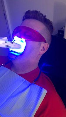 Triple Whitening Session 3-twenty minute sessions under the LED Laser light