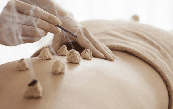 Moxibustion at Evolve Acupuncture and Physical Therapy in Oyster Bay Long Island.