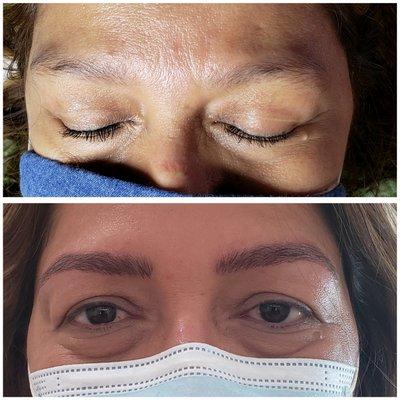 Microblading