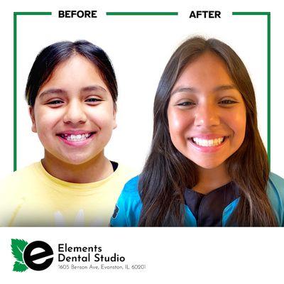 We love a great before and after! Thank you to our amazing patient!