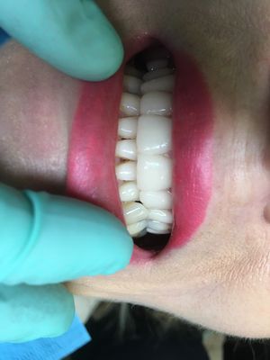 Cosmetic dentistry for all