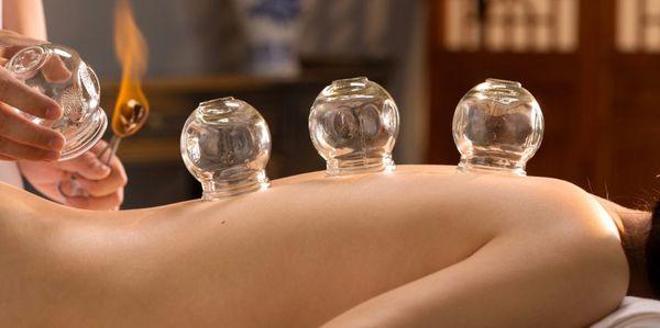 Traditional Cupping!