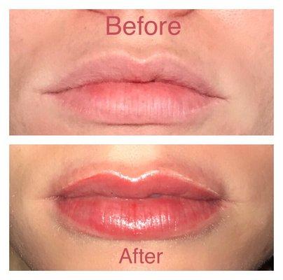 Before and After Microbladed Lips