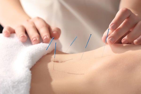 Sage Acupuncture