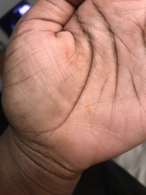 Hand stained from sauce