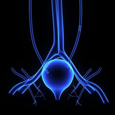 Prostate Artery Embolization