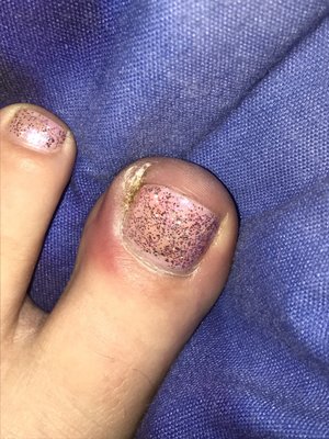 Will never go back got an infection after a pedicure on January 17, 2017 from Brenda..