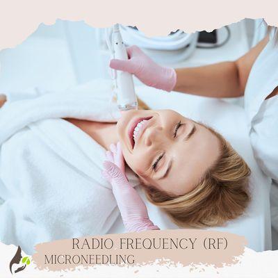 Radio Frequency Microneedling