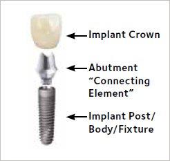 Jay C. Shartzer, DDS