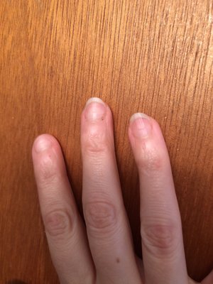 This is the result of my manicure--semilunar dents in each of my nails from electric filing. Photo taken after I removed polish.