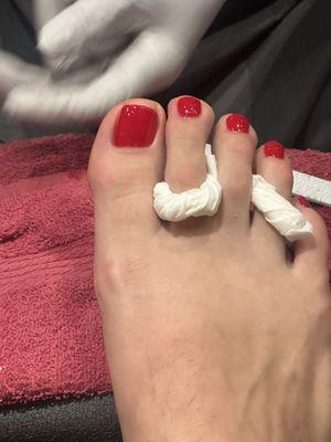 Worst pedicure