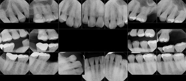 Carson Dental Designs