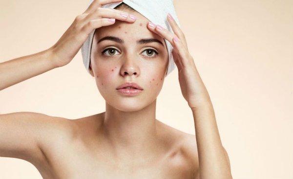 Problem skin? We have the best treatments and a very helpful ebook solving acne internally and externally. Schedule a detox facial today.