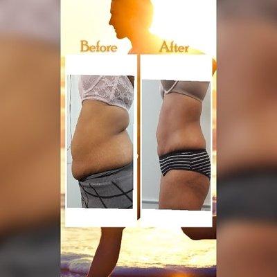 Bella SPA Skin Care & Weight Loss