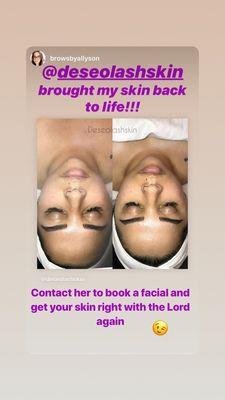 Custom Facial