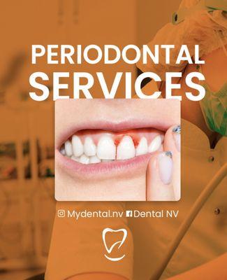 Periodontal Services  #dental care