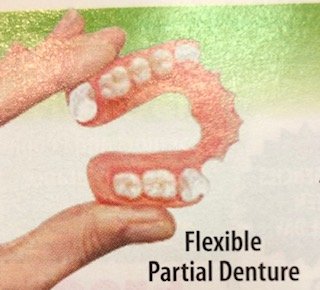 Lightweight Flexible Partial Denture.